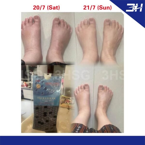 【Buy 1 Free 1】(Free Size) Terahertz Quantum Graphene Socks - Image 7