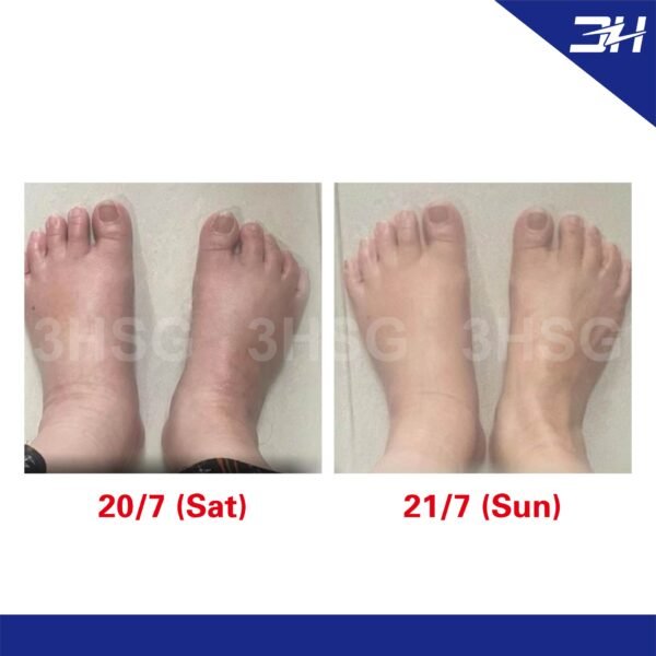 【Buy 1 Free 1】(Free Size) Terahertz Quantum Graphene Socks - Image 8