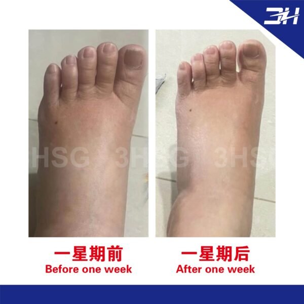 【Buy 1 Free 1】(Free Size) Terahertz Quantum Graphene Socks - Image 9